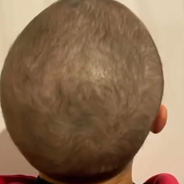 Before image