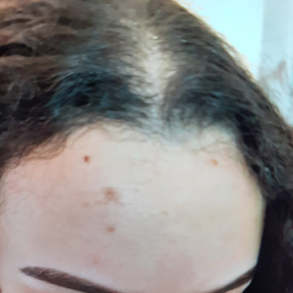 Before image