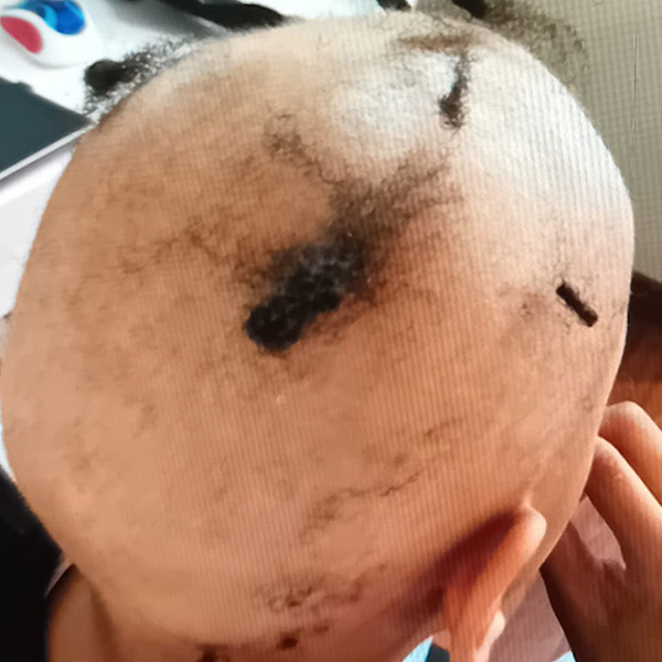 Before image