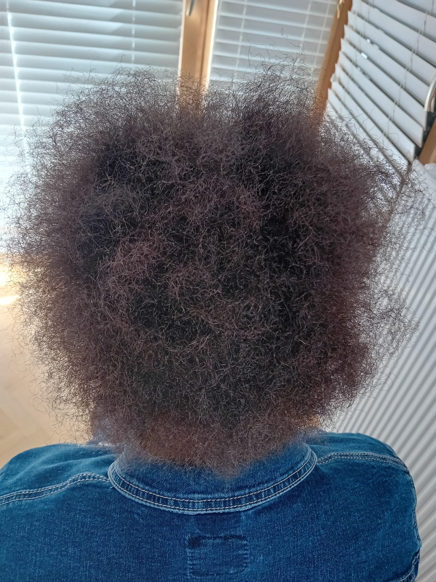 Cheveux plus avant/après trichologue Boulogne Billancourt
